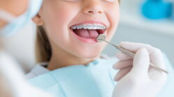 小児矯正の治療の様子