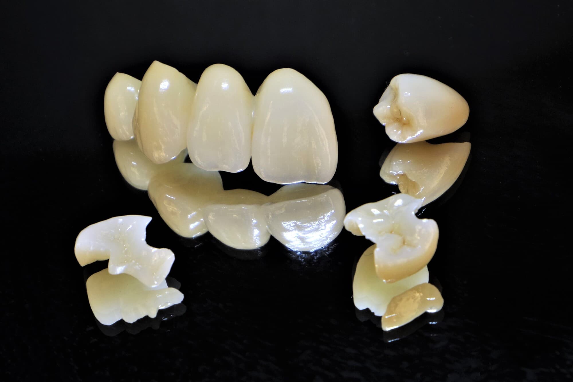 色々なセラミックの歯